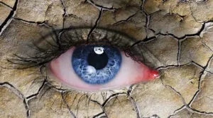 Что такое синдром сухого глаза и как его лечить?