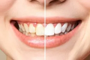 Здоровые зубы / Фото: umkabelmed.by